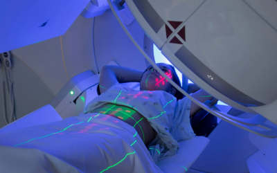 Wat zijn de bijwerkingen van radiotherapie bij prostaatkanker?